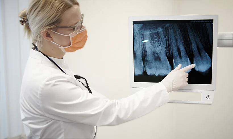 Mechanical Root Canal Treatment